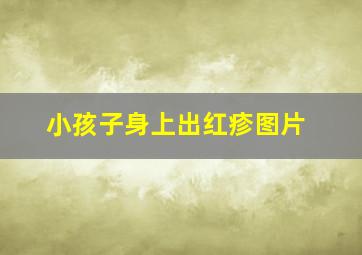 小孩子身上出红疹图片