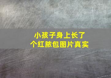 小孩子身上长了个红脓包图片真实