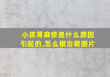 小孩荨麻疹是什么原因引起的,怎么根治呢图片