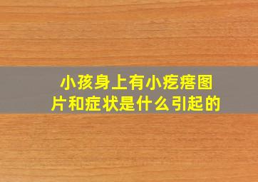 小孩身上有小疙瘩图片和症状是什么引起的