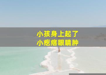 小孩身上起了小疙瘩眼睛肿