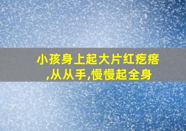 小孩身上起大片红疙瘩,从从手,慢慢起全身