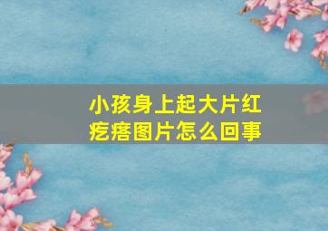 小孩身上起大片红疙瘩图片怎么回事