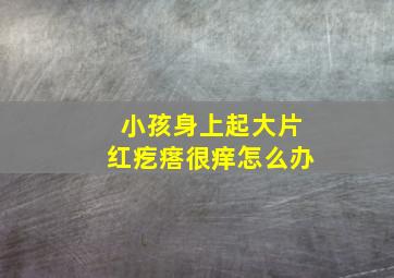 小孩身上起大片红疙瘩很痒怎么办