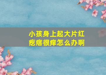 小孩身上起大片红疙瘩很痒怎么办啊