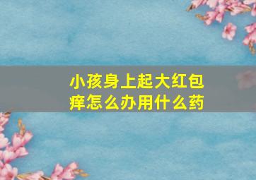 小孩身上起大红包痒怎么办用什么药