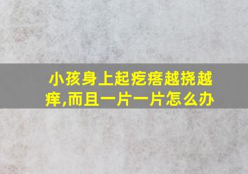 小孩身上起疙瘩越挠越痒,而且一片一片怎么办