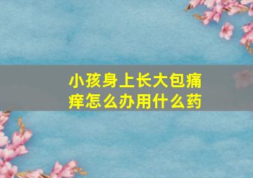 小孩身上长大包痛痒怎么办用什么药