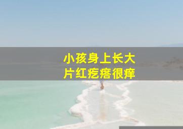 小孩身上长大片红疙瘩很痒