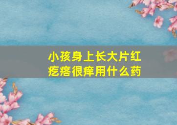 小孩身上长大片红疙瘩很痒用什么药