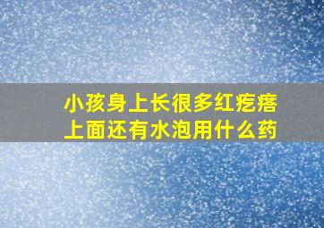 小孩身上长很多红疙瘩上面还有水泡用什么药