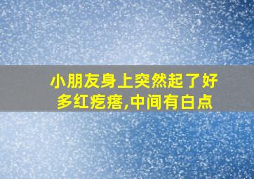 小朋友身上突然起了好多红疙瘩,中间有白点