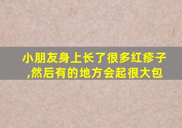 小朋友身上长了很多红疹子,然后有的地方会起很大包