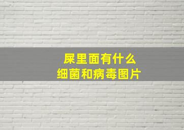 屎里面有什么细菌和病毒图片