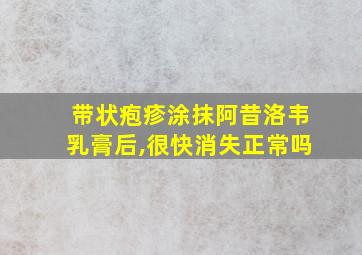 带状疱疹涂抹阿昔洛韦乳膏后,很快消失正常吗