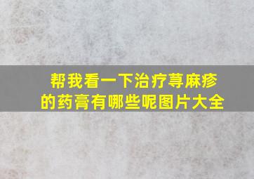 帮我看一下治疗荨麻疹的药膏有哪些呢图片大全