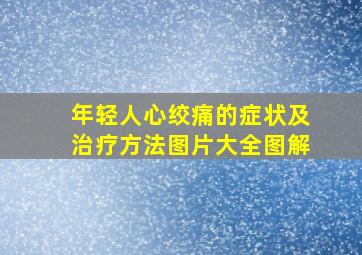 年轻人心绞痛的症状及治疗方法图片大全图解