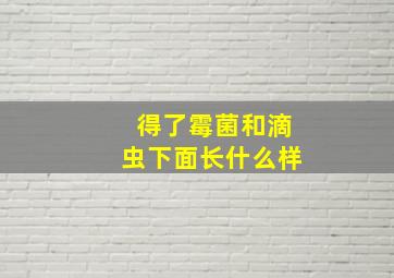 得了霉菌和滴虫下面长什么样