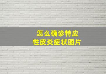 怎么确诊特应性皮炎症状图片