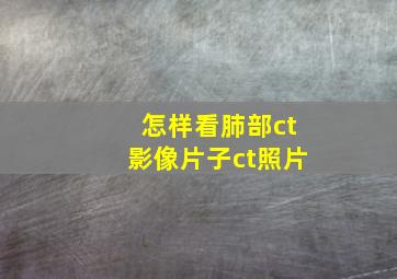 怎样看肺部ct影像片子ct照片