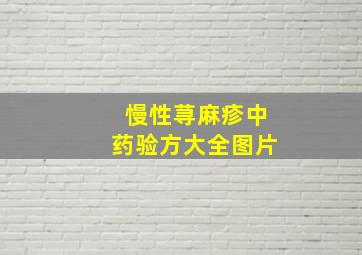 慢性荨麻疹中药验方大全图片