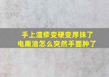 手上湿疹变硬变厚抹了电鹿油怎么突然手面肿了