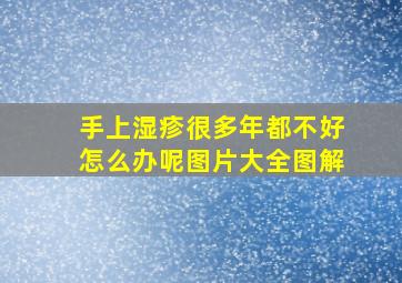 手上湿疹很多年都不好怎么办呢图片大全图解