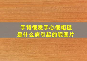 手背很嫩手心很粗糙是什么病引起的呢图片