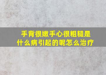 手背很嫩手心很粗糙是什么病引起的呢怎么治疗