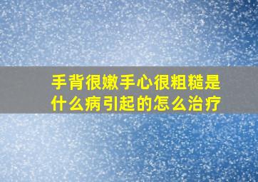 手背很嫩手心很粗糙是什么病引起的怎么治疗