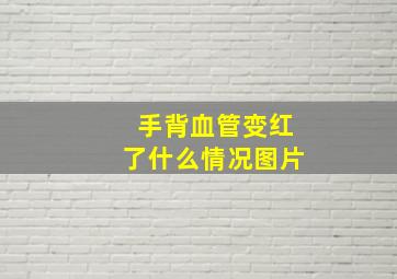 手背血管变红了什么情况图片