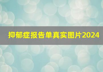 抑郁症报告单真实图片2024