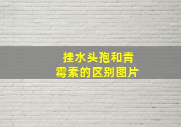 挂水头孢和青霉素的区别图片