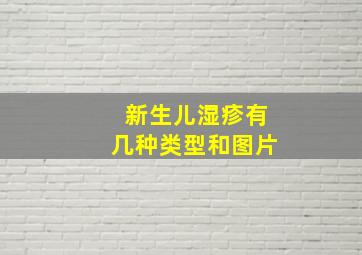 新生儿湿疹有几种类型和图片