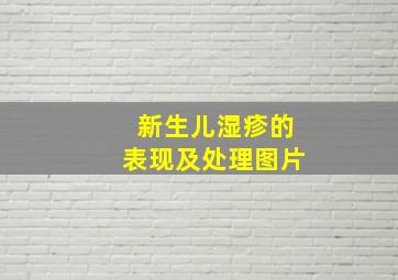 新生儿湿疹的表现及处理图片