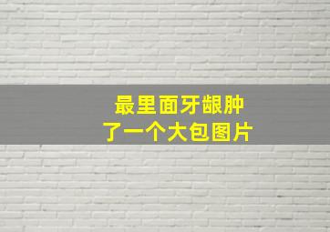 最里面牙龈肿了一个大包图片