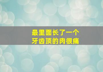 最里面长了一个牙齿顶的肉很痛