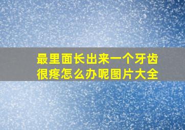 最里面长出来一个牙齿很疼怎么办呢图片大全