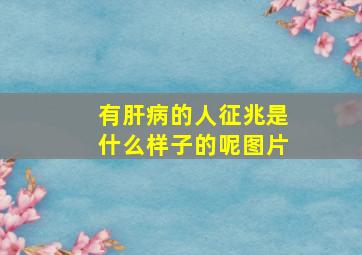 有肝病的人征兆是什么样子的呢图片