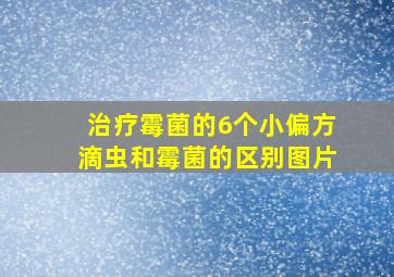 治疗霉菌的6个小偏方滴虫和霉菌的区别图片