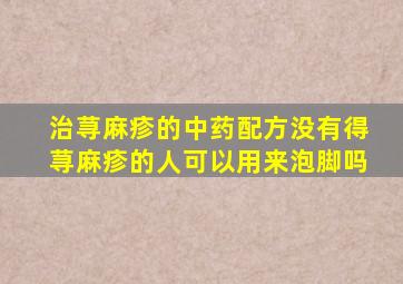 治荨麻疹的中药配方没有得荨麻疹的人可以用来泡脚吗