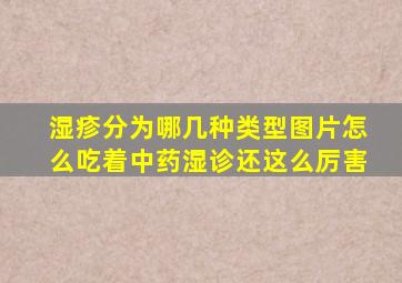 湿疹分为哪几种类型图片怎么吃着中药湿诊还这么厉害