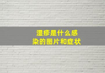 湿疹是什么感染的图片和症状