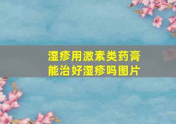 湿疹用激素类药膏能治好湿疹吗图片