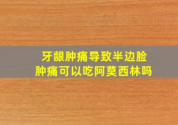 牙龈肿痛导致半边脸肿痛可以吃阿莫西林吗