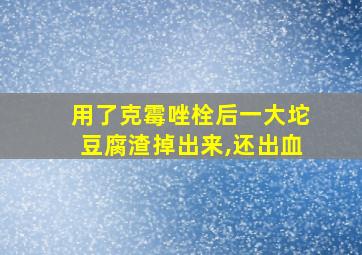 用了克霉唑栓后一大坨豆腐渣掉出来,还出血