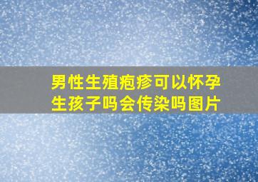 男性生殖疱疹可以怀孕生孩子吗会传染吗图片