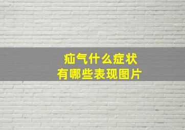 疝气什么症状有哪些表现图片