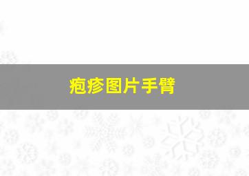 疱疹图片手臂