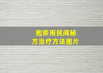 疱疹用民间秘方治疗方法图片